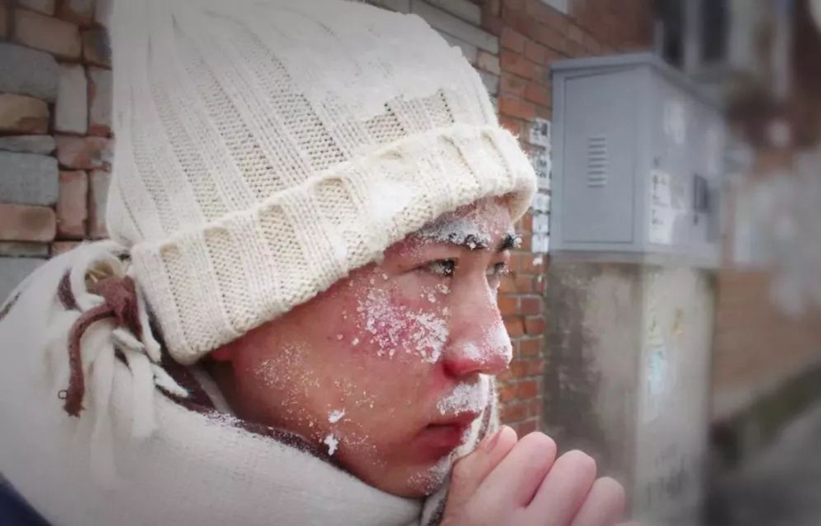 冬天脸上高原红,冬天一热脸就高原红是怎么回事