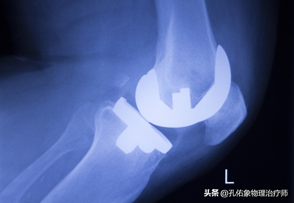 膝痛一招教你解决,膝痛怎样锻炼