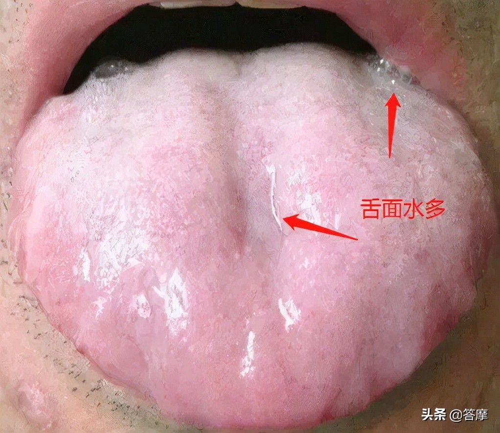舌象脏腑图,体内有湿寒的舌象
