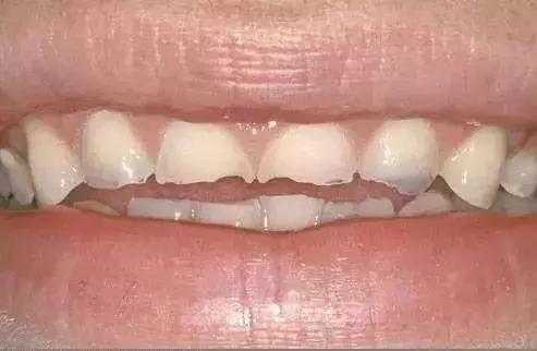 除了帅简直就一无是处,除了帅其他还有什么优点