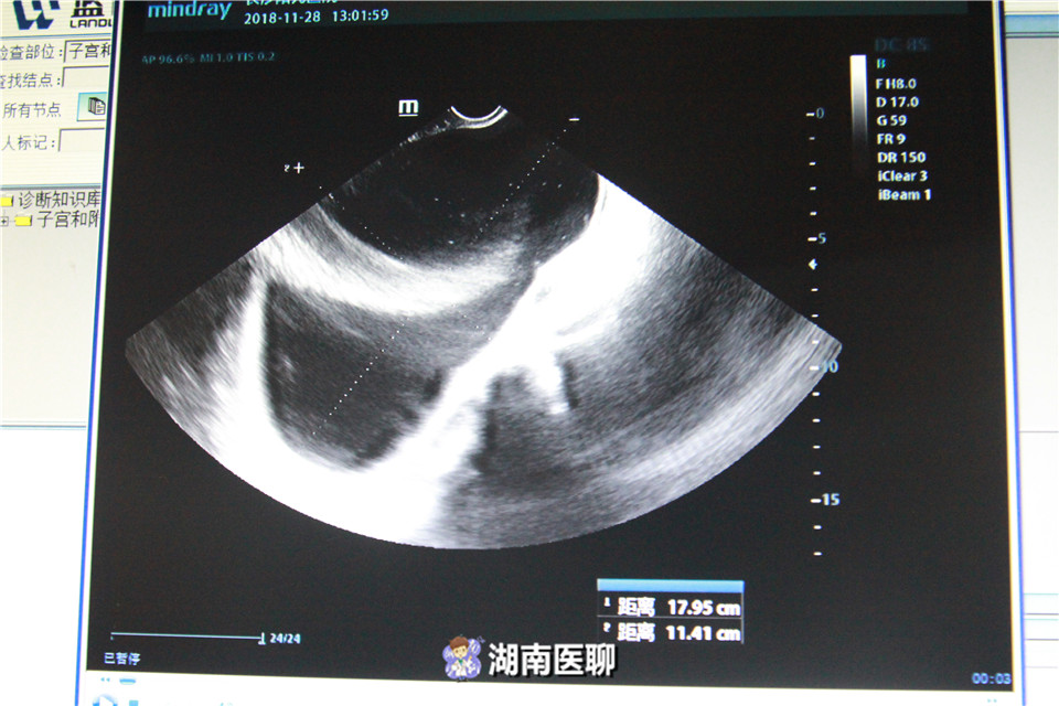 女子备孕2年未能怀上,备孕一年未成功的女人
