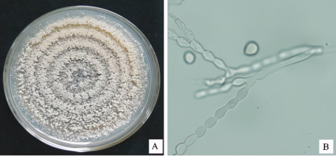 李子高温落果严重怎么办,李子结果后会发黄掉落什么原因