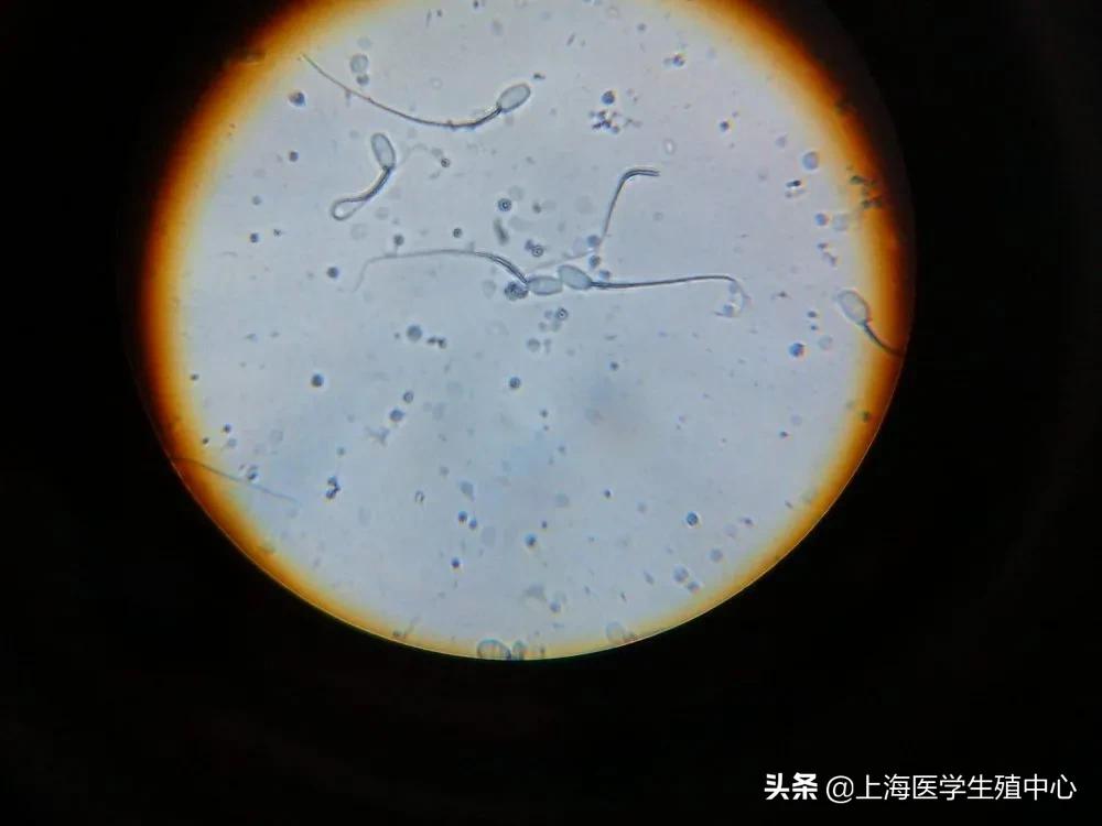 通过精子颜色可以看出精子质量吗,精子质量主要看哪几个指标