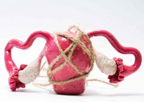 妇科月经量多怎么治,妇科月经病常见疾病