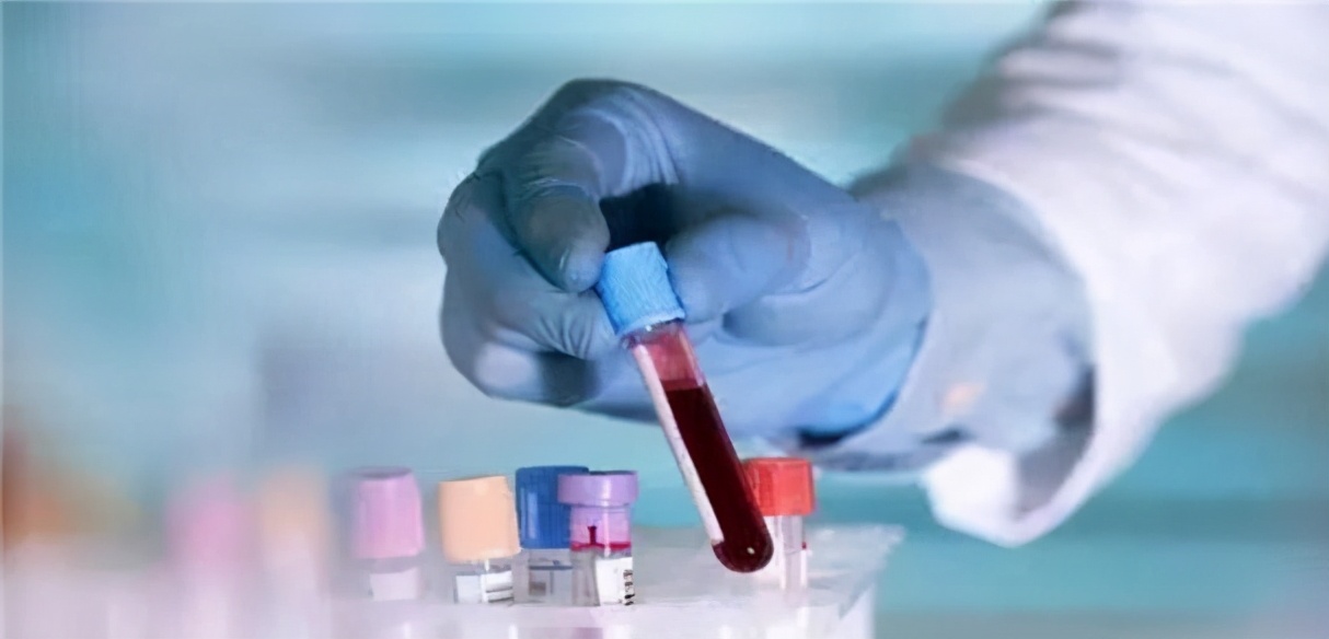 熊猫血打胎后再生算二胎吗,熊猫血怀二胎会对孕妇会有危险吗