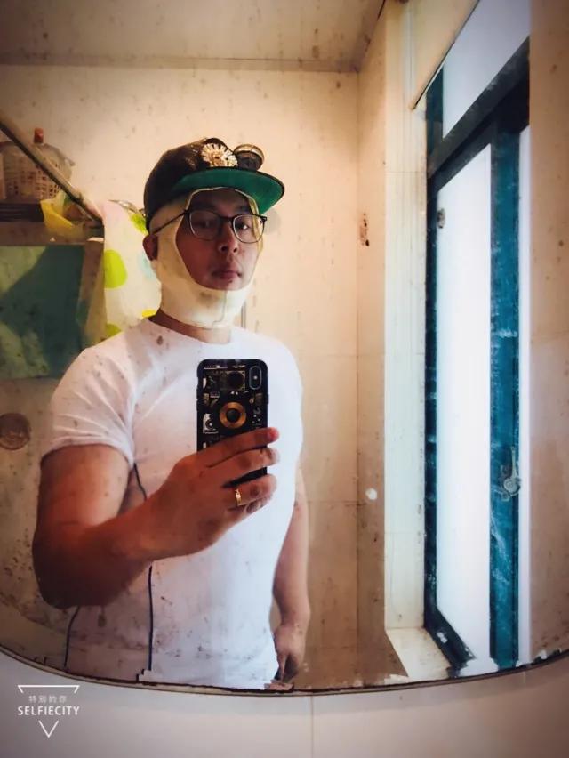 抽脂亲身经历回忆,抽脂血泪史