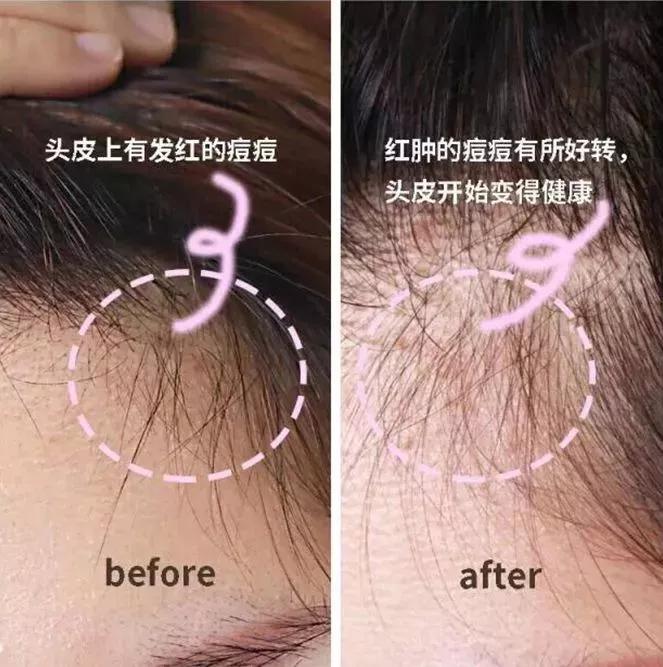 洗洗就能直发的洗发水测评,一款好用到爆的柔顺洗发水推荐