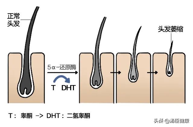 身上的皮肤可以移植到脸上吗,毛发可以移植到头皮吗