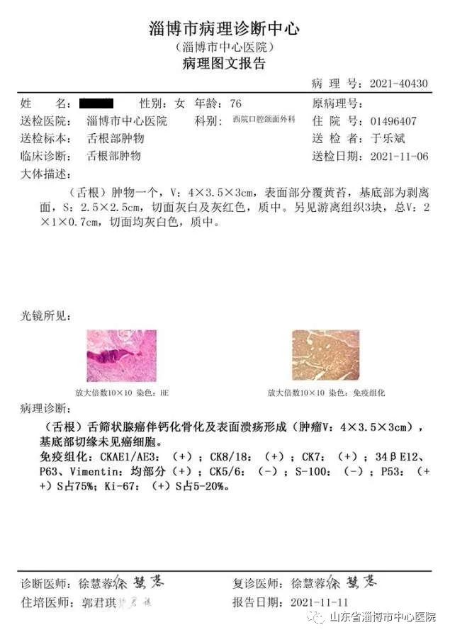 口腔颌面头颈肿瘤外科手术,口腔颌面部恶性肿瘤患者手术治疗