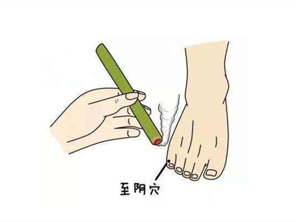 胎位不正的原因和注意事项,胎位不正最佳调整方法