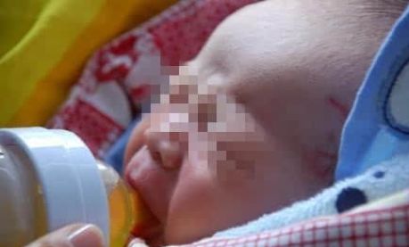 花椒面止血，活蝌蚪下火，开水止抽搐……父母不用考试，细思恐极啊