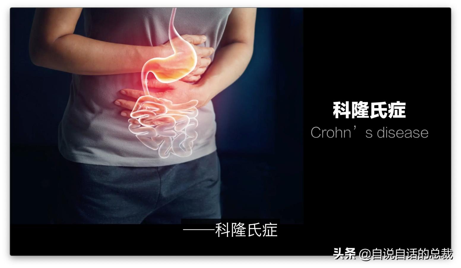 吃翔救命,最奇葩的药,人体“第二大脑”的五个惊奇