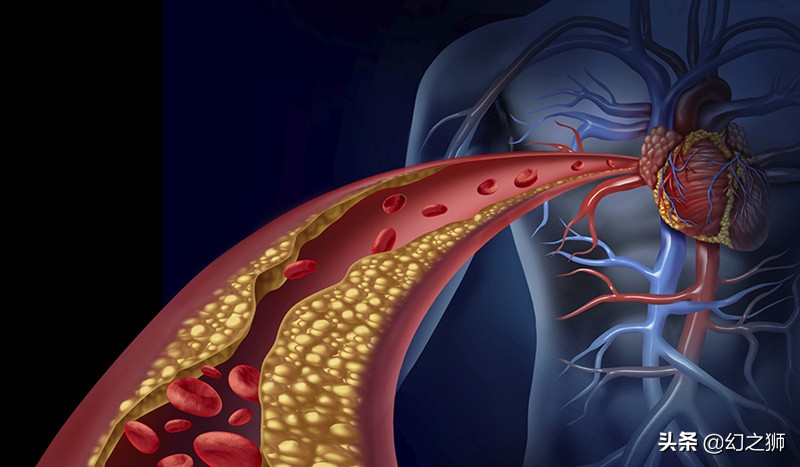 大脑缺氧最佳锻炼方法,有什么动作能缓解大脑缺氧