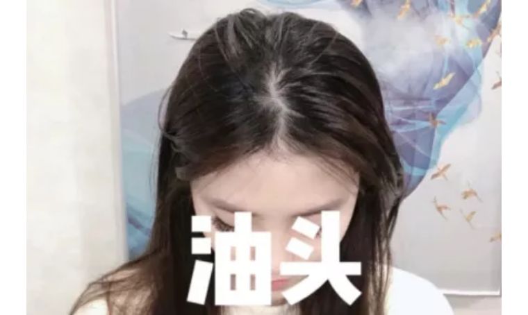 日本滋润头发防脱发的洗发水,日本洗发水头发干枯毛躁