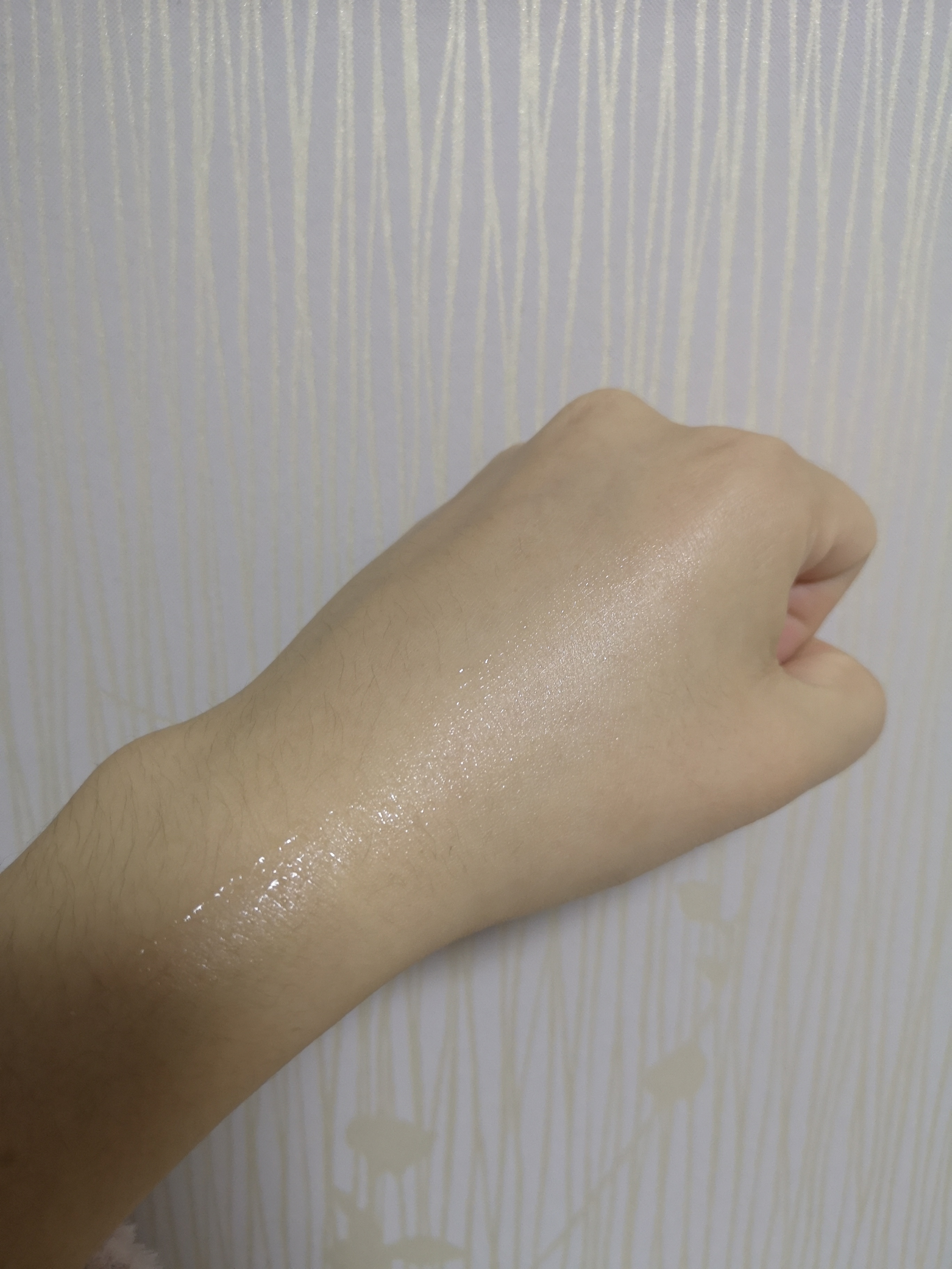 bioeffect蓓欧菲精华用后过敏,bioeffect蓓欧菲冰岛精华能祛痘吗