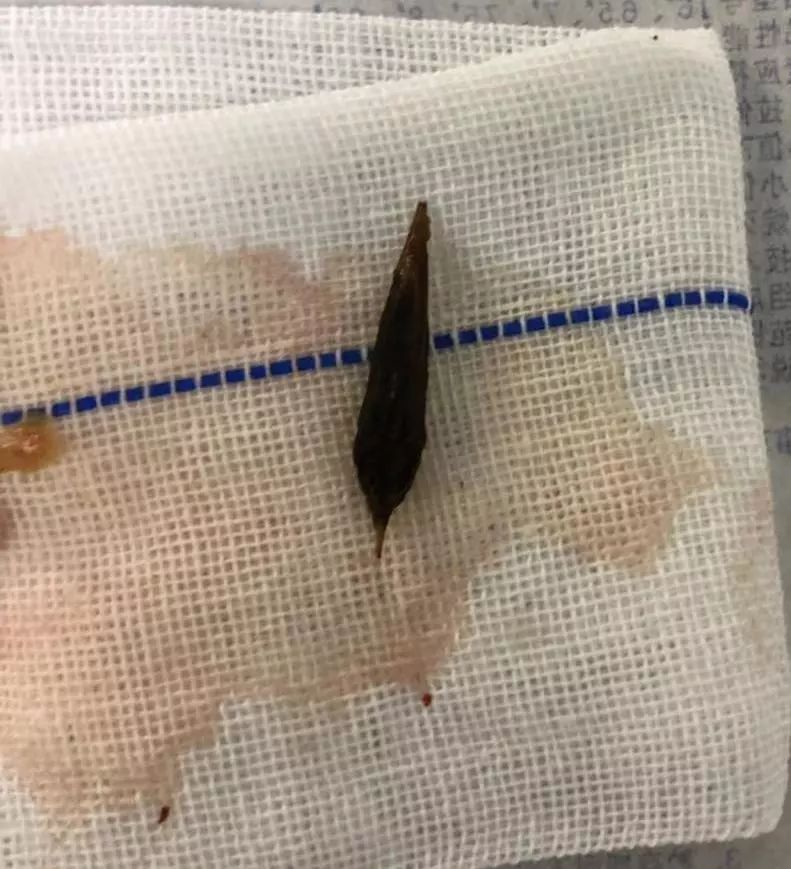 一颗炮弹引发的血案,一颗扣子引发的杀人案