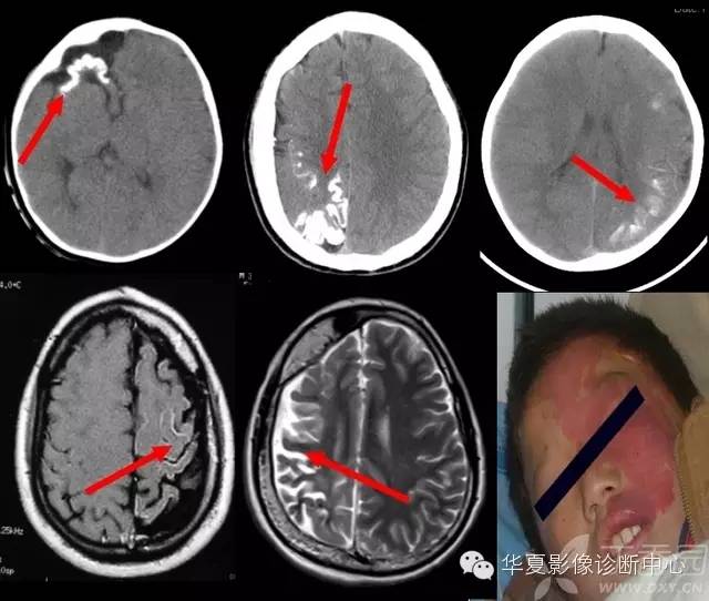 神经系统解剖及定位诊断视频,神经系统影像解析