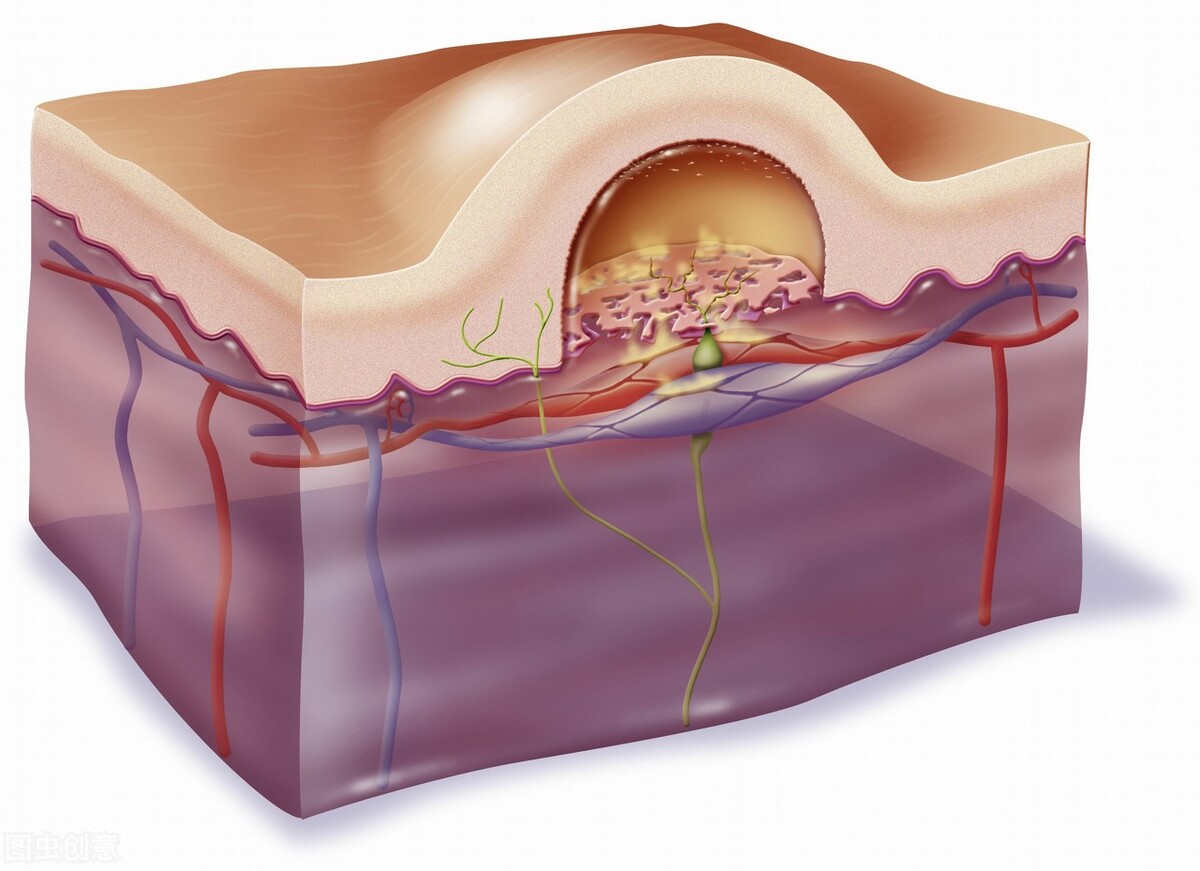 男生脚被烫伤,男生脚冻伤