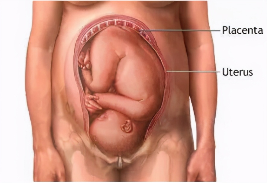 胎盘位置到底怎么看？