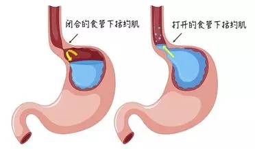 经常胃不舒服胃烧心怎么治疗,经常胃部不舒服吃什么比较养胃