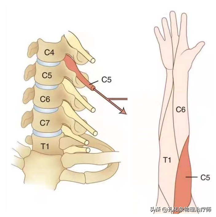 颈椎病用什么方法治疗最有效呢,颈椎病怎么治疗又简单又有效果呢