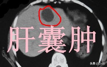 涓哄暐鑲濆泭鑲垮尰鐢熶笉寤鸿浠嬪叆娌荤枟,姊佸尰鐢熻倽鍥婅偪鎬庝箞娌荤枟