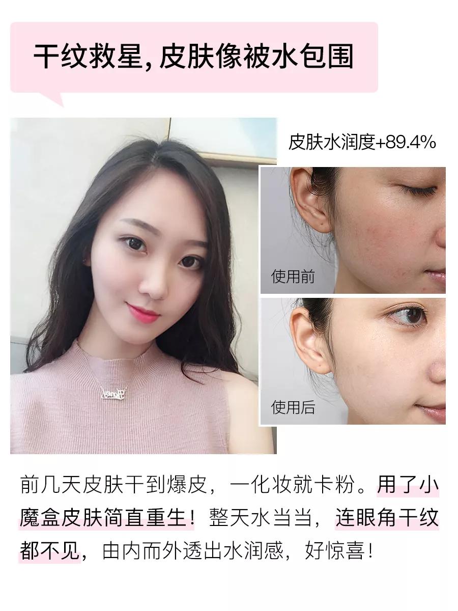 急救面膜3分钟见效,急救补水面膜爆款面膜