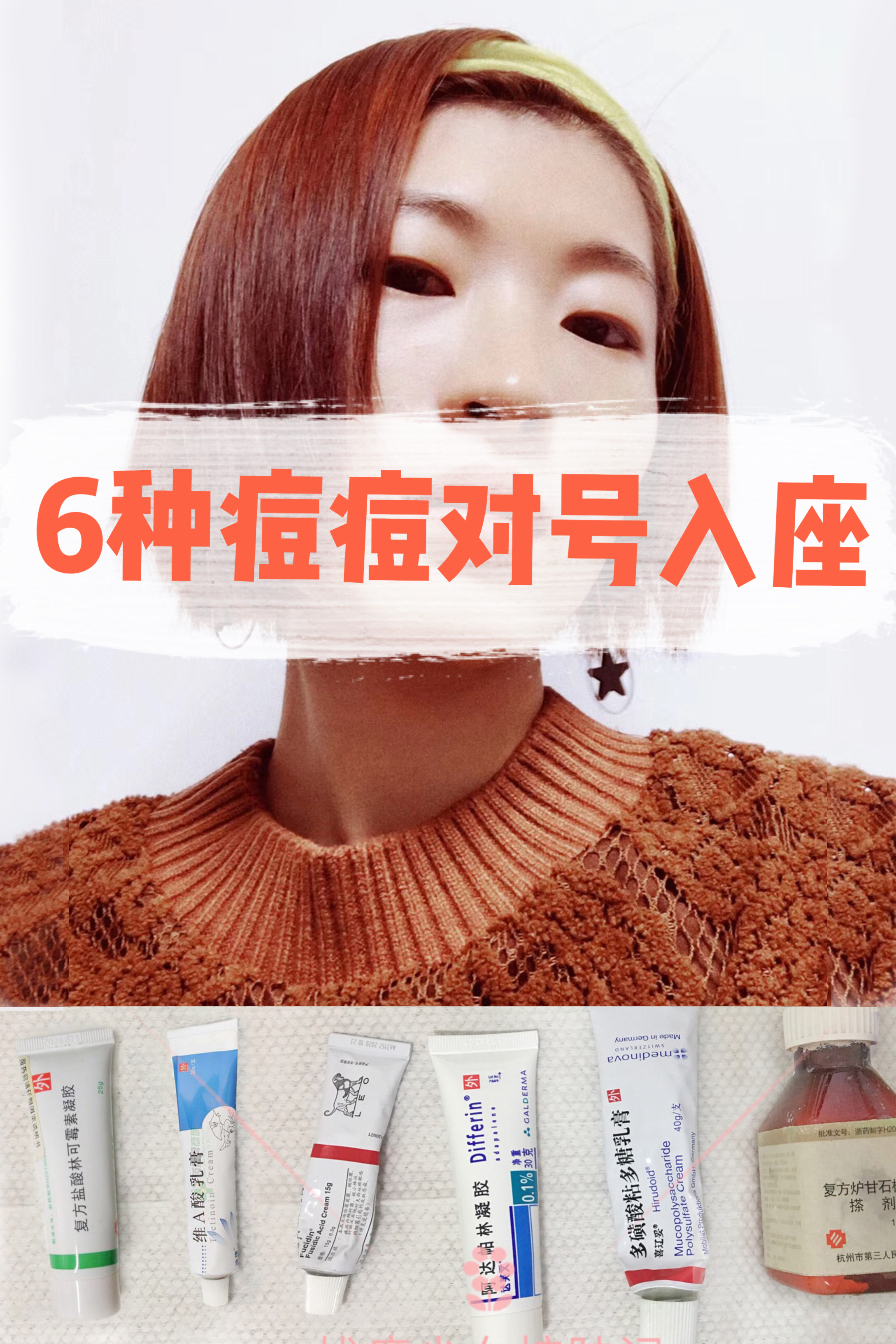 6种痘痘对号入座，1分钟教会你认清痘痘类型，对症战痘！