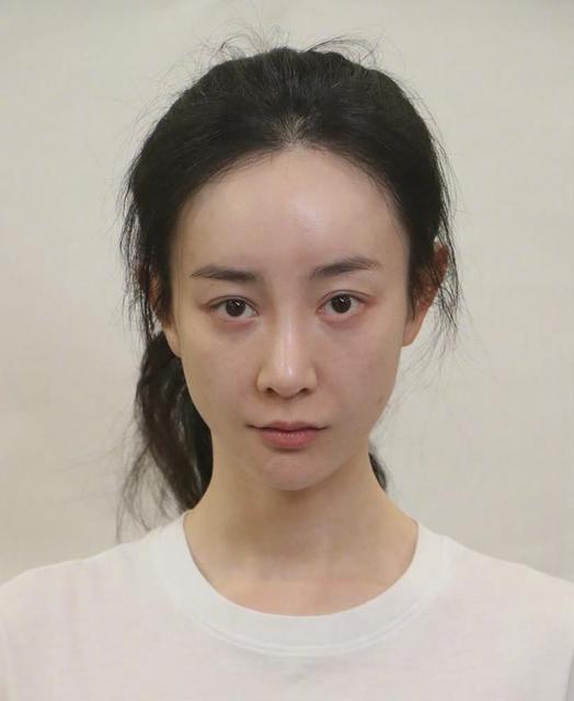 张檬取出假体颜值重回巅峰,张檬取出假体颜值重回巅峰照片