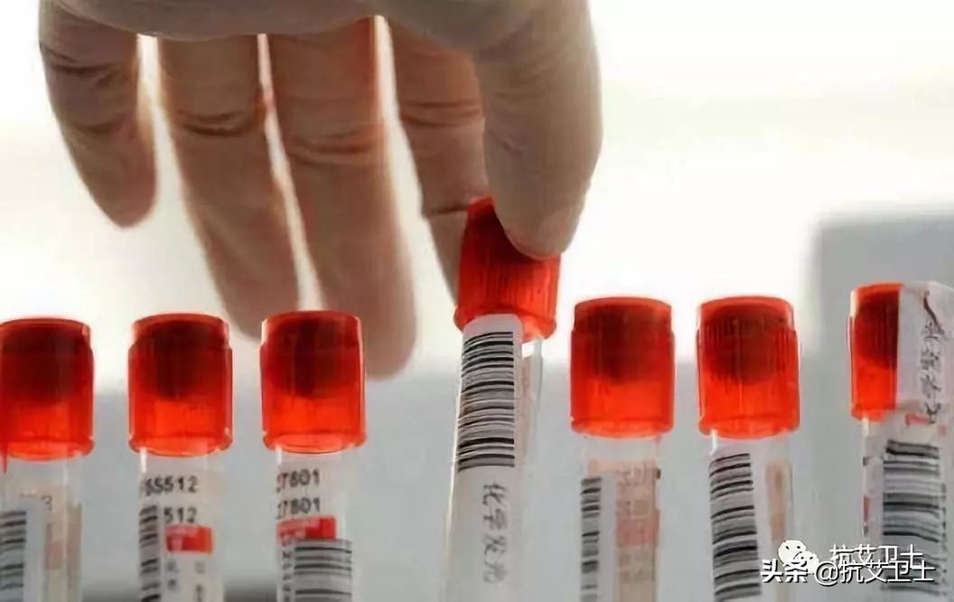 艾滋病怎么治疗,艾滋病怎么检查最准确