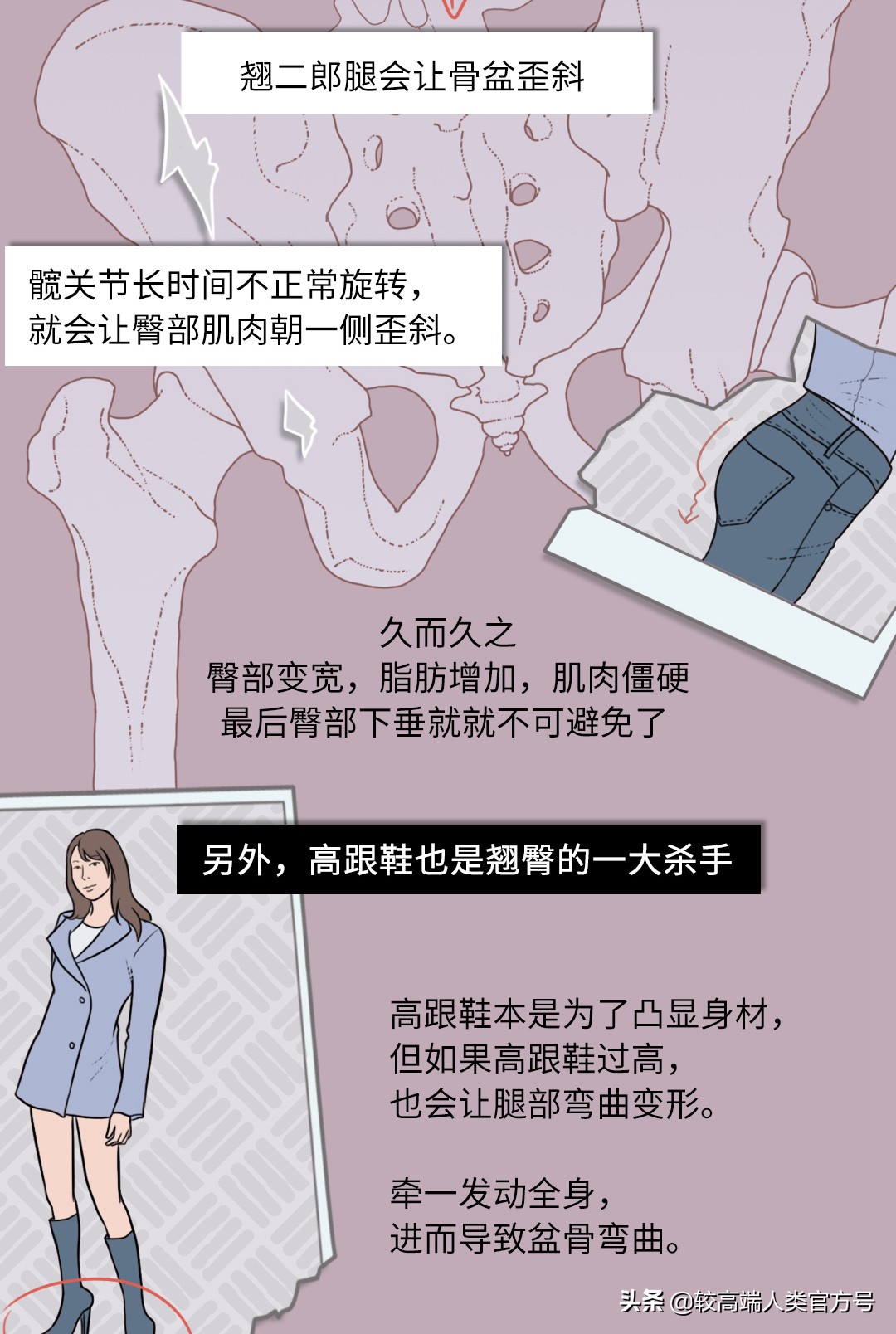 如何拥有一颗光洁白皙的屁股?