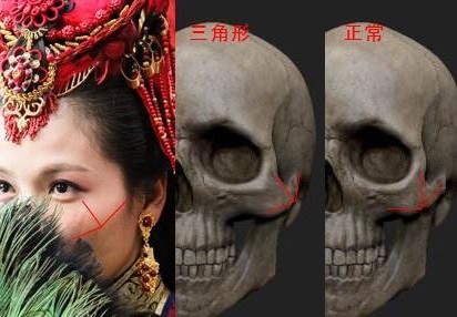 颧骨高适合什么修饰,颧骨塑造