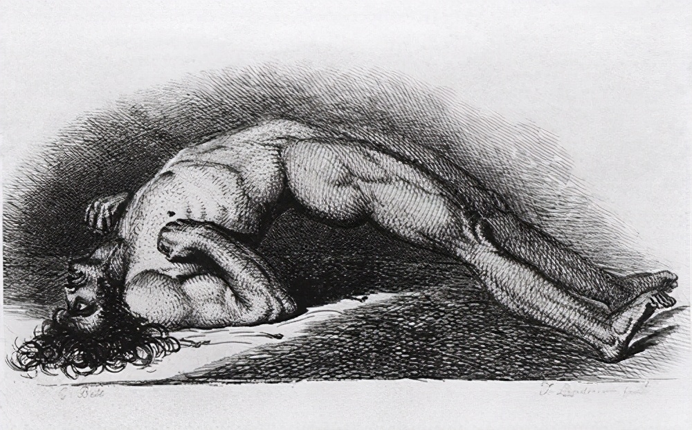 烫伤后打破伤风是否预防感染,烫伤后不痛了可以不打破伤风吗