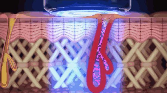 十年光学美容仪,初学者应该怎么选择美容仪