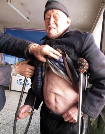 鎶楄仈鍥炲繂,鎶楄仈鎴樺＋鍥炲繂