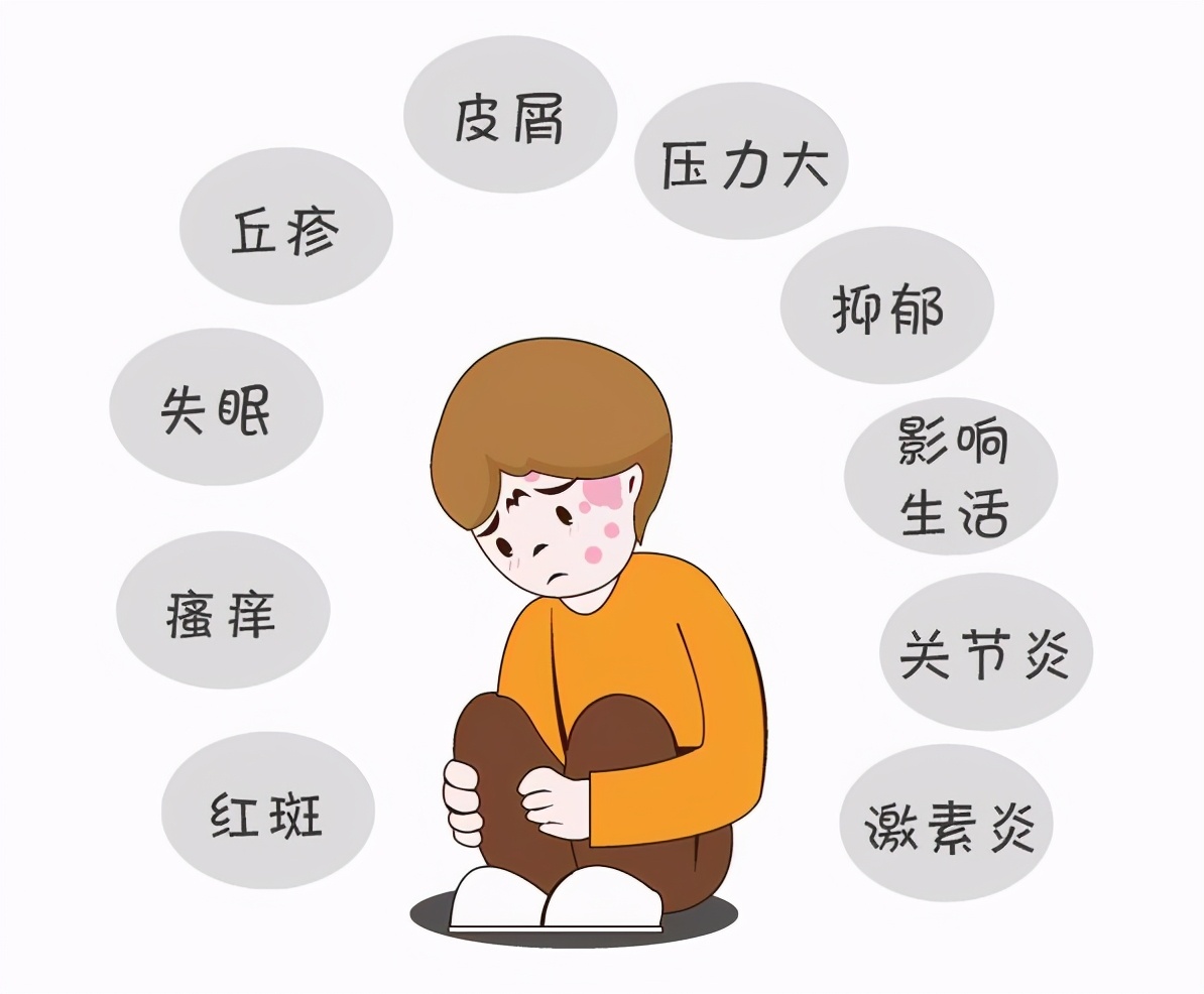 银屑病一直在治疗但效果不好，该放弃吗？