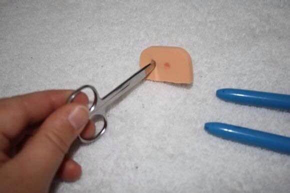 鹦鹉八字脚一个月怎么矫正,鹦鹉八字腿齐毛了还能矫正吗