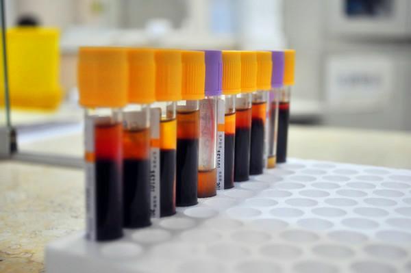 肾虚脾气弱的人有哪些症状,肾虚身体的症状及表现