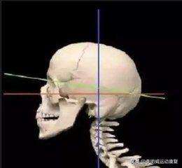 富贵包怎么消除最好方子,富贵包怎么消除视频教学