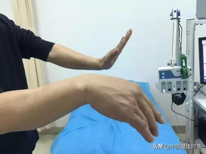 酒后摔伤手指麻木无力不愈,酒后手指麻木无力