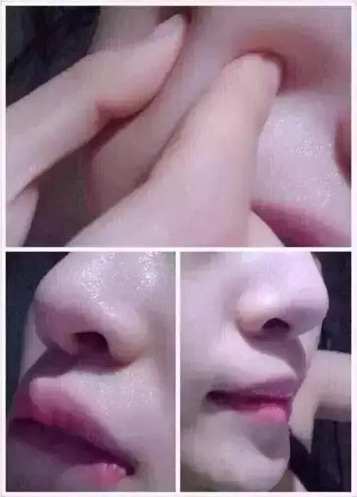 水光针究竟靠不靠谱,水光针究竟怎么选