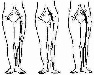 脚肿要警惕四种病手突出一块,脚肿要警惕四种病可以用醋擦吗
