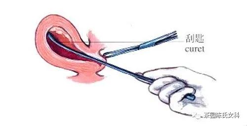 流产后怎么调理才能恢复最好