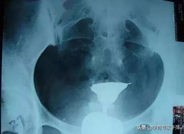 于萍主任青岛,青岛妇儿输卵管造影怎么样