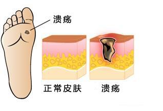 这7种癌症或能治愈,这7种癌都是吃出来的
