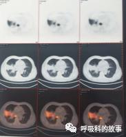 怎么应用统计学做调查,统计学方法可以解决的主要问题