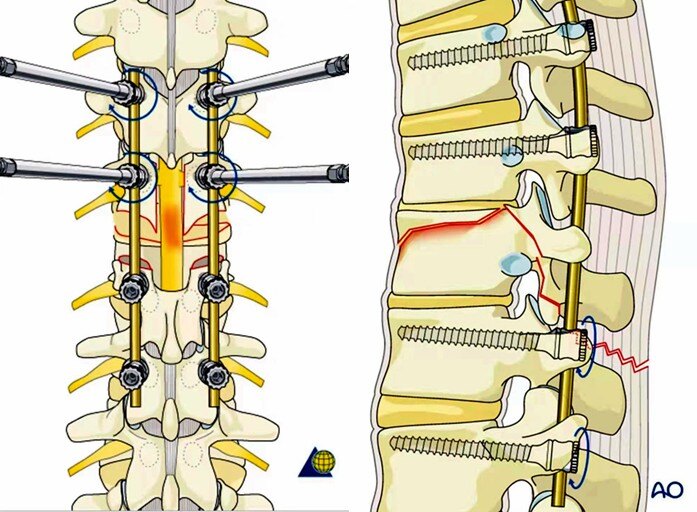 分秒必争救伤员,分秒必争的抢救