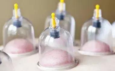 万万没想到，我们一家人的感情毁在了刮痧、拔罐上……