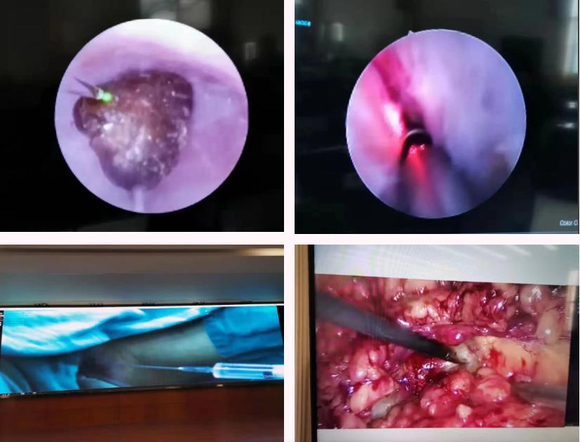 汇智共享开启学科共建新篇章——景德镇市第二人民医院成功举办泌尿腔镜微创技术瓷都高峰论坛