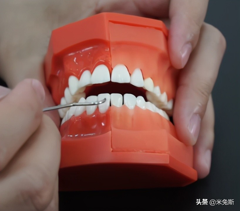 大家牙齿发育的怎么样,大家牙齿都长什么样